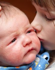 Bébé souffrant de dermatite atopique