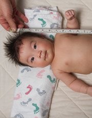 Bébé avec un retard saturo-pondéral